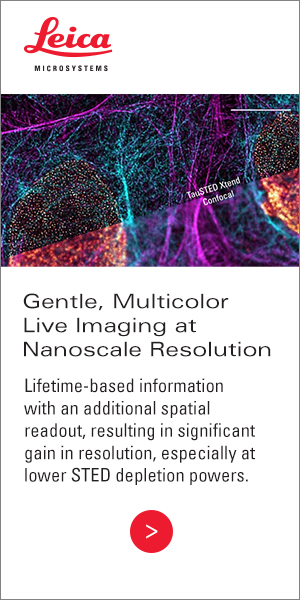 TauSTED Xtend banner_300x600 (1)