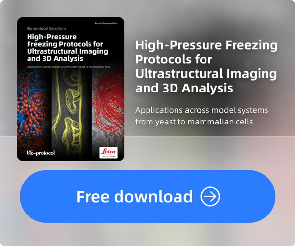 High-Pressure Freezing Protocols for Ultrastructural Imaging and 3D Analysis