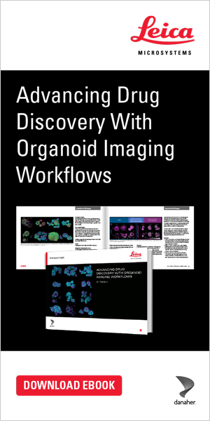 What’s the Best Organoid Imaging Approach for Early Drug Discovery?