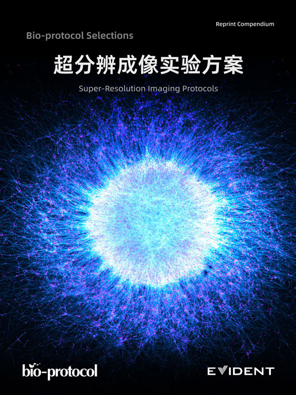 超分辨成像实验方案