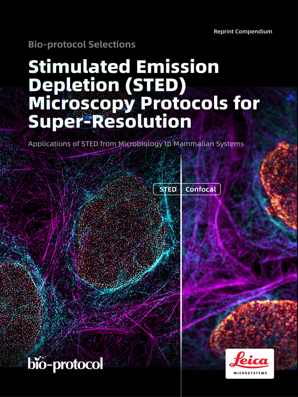 Stimulated Emission Depletion (STED) Microscopy Protocols for Super-Resolution