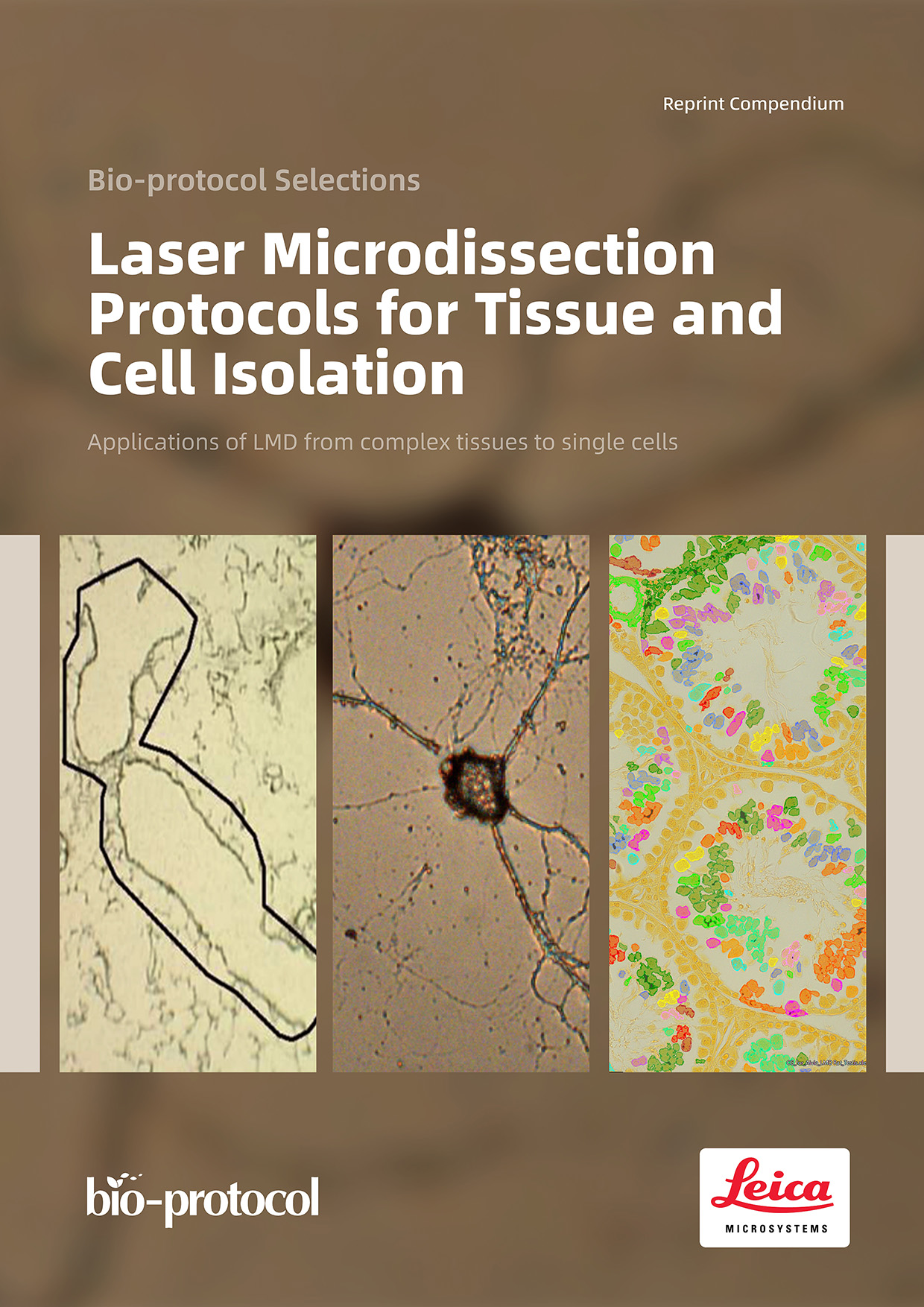 Laser Microdissection Protocols for Tissue and Cell Isolation