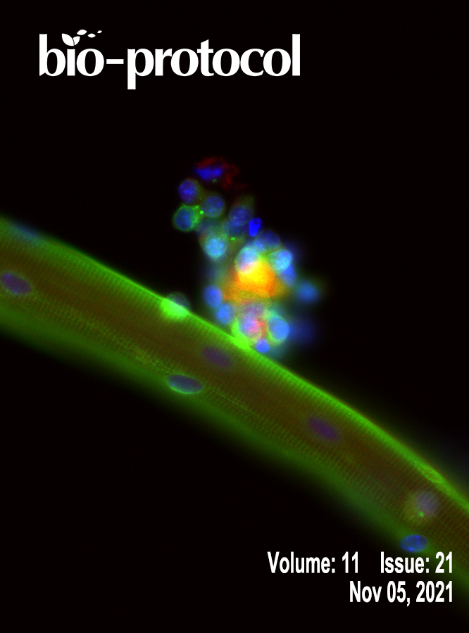 Issue Cover - Bio-protocol, Volume 11, Issue 21