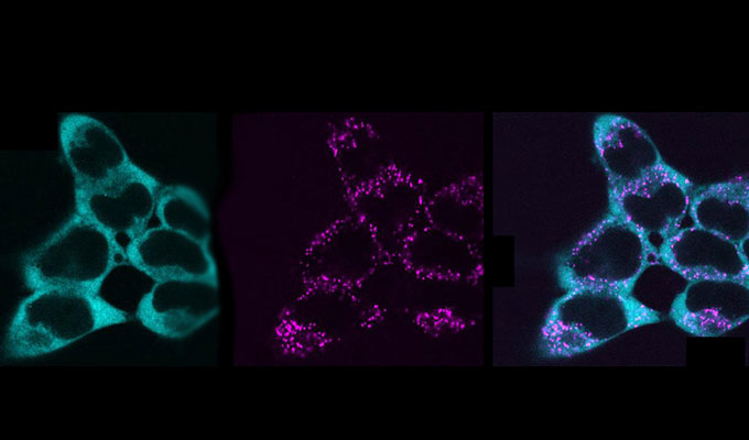 Machine learning–assisted quantification of organelle abundance using Fiji