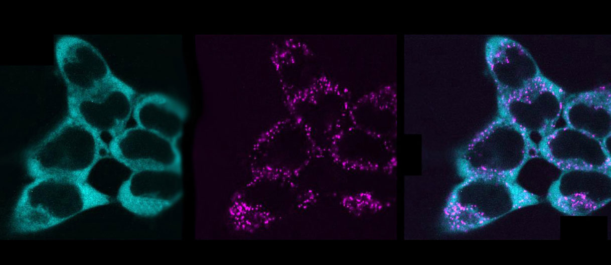 Machine learning–assisted quantification of organelle abundance using Fiji