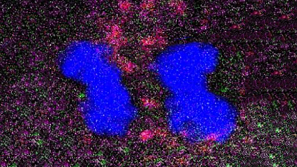 Label retention expansion microscopy (LR-ExM) with Aydin denoising