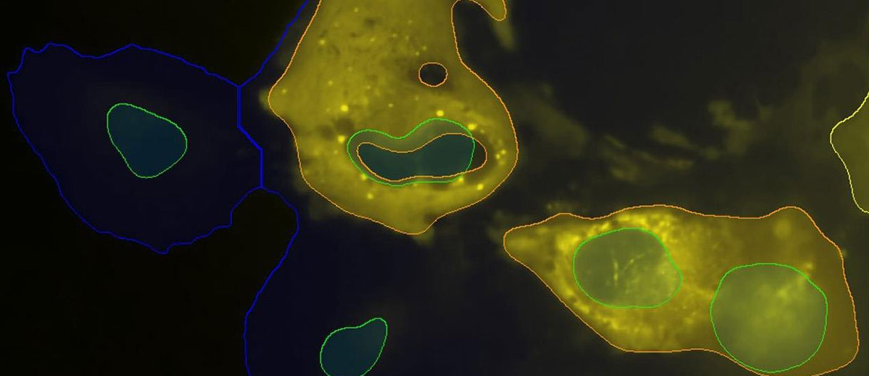 Visualizing diverse RNA functions in living cells with the Spinach™ family of fluorogenic aptamers