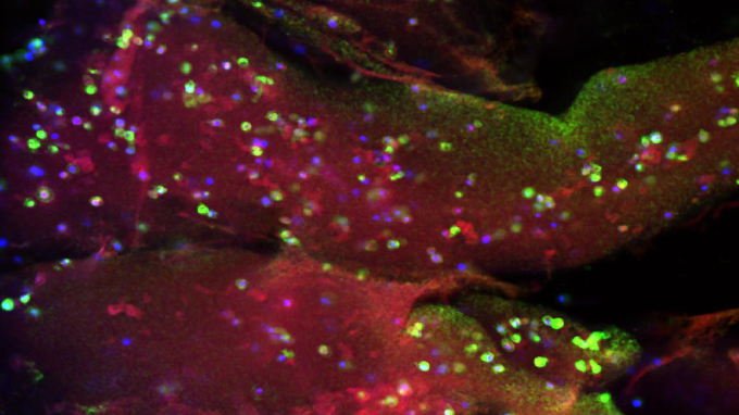 3D printing personalized tissue models