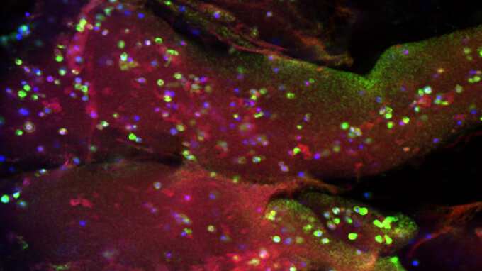 3D printing personalized tissue models