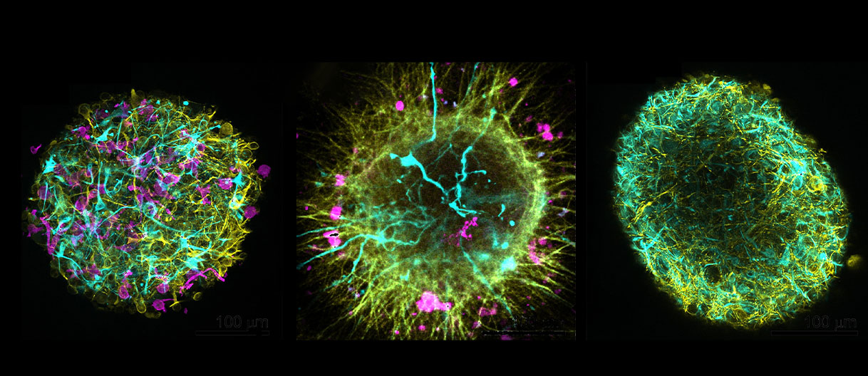3D human multi-cell type neurospheres from iPSCs