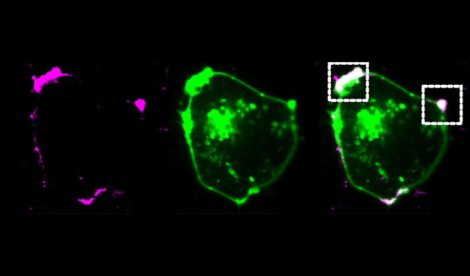 Decoding condensate dynamics: Microscopy, FRAP, and XPCS