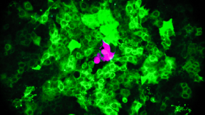 Optogenetics for cell death research: tools and applications