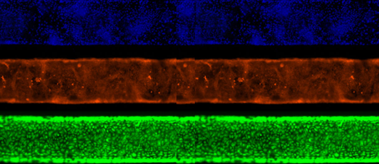 A protocol guide to micro milling for bio-microfluidics