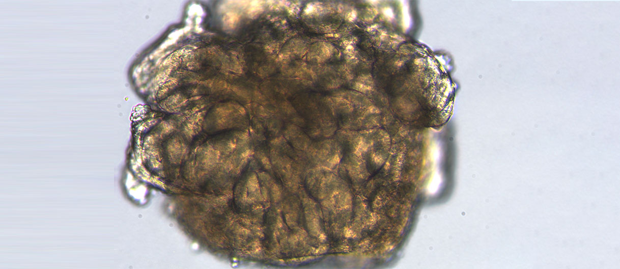 Engineering next-generation kidney organoids: Enhancing physiological relevance, reproducibility, and scalability