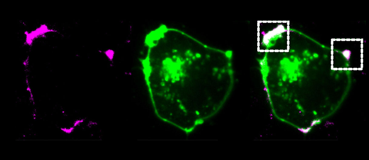 Decoding condensate dynamics: Microscopy, FRAP, and XPCS