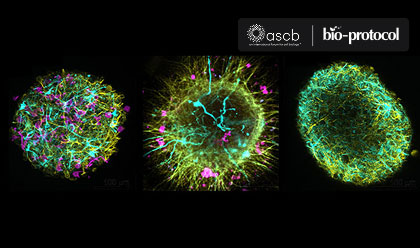 3D human multi-cell-type neurospheres from iPSCs